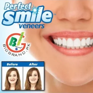 Alternative view of طقم أسنان علوي Perfect Smile قابل للإزالة