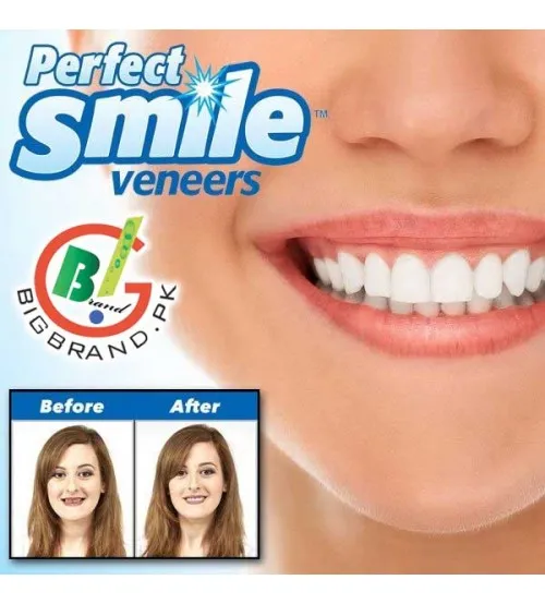 طقم أسنان علوي Perfect Smile قابل للإزالة - الصورة 2