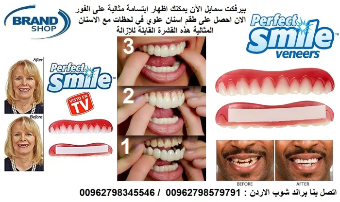 طقم أسنان علوي Perfect Smile قابل للإزالة - الصورة 4